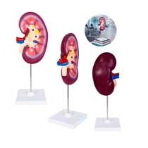 MODELO ANATOMICO RIÑON NEFRO