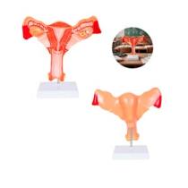 MODELO ANATOMICO UTERO 