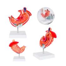MODELO ANATOMICO ESTOMAGO GASTRO