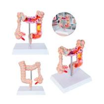 MODELO ANATOMICO INTESTINO COLON